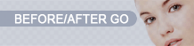 BEFORE/AFTER Go
